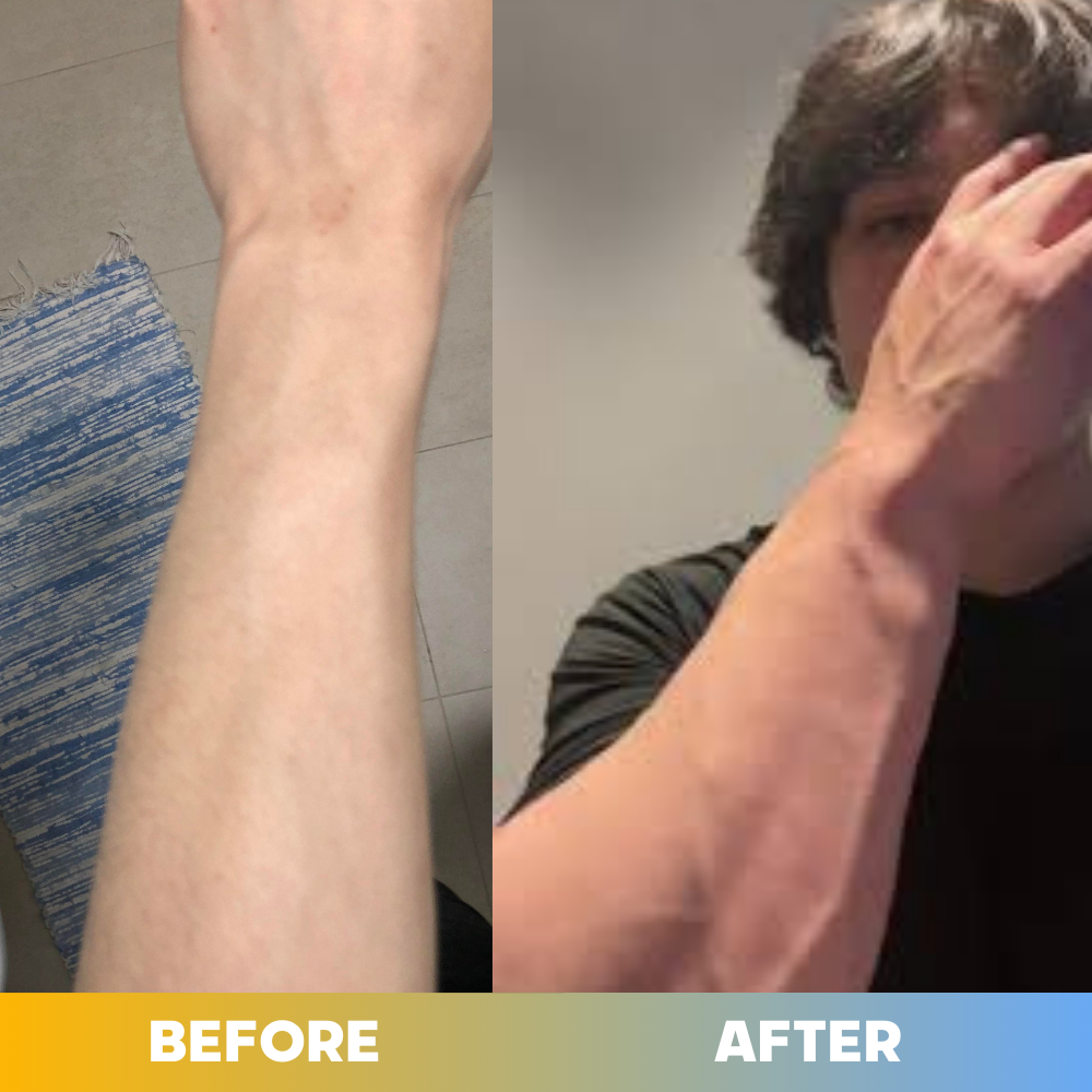 Forearm Enhancer- Improve Strength & Definition